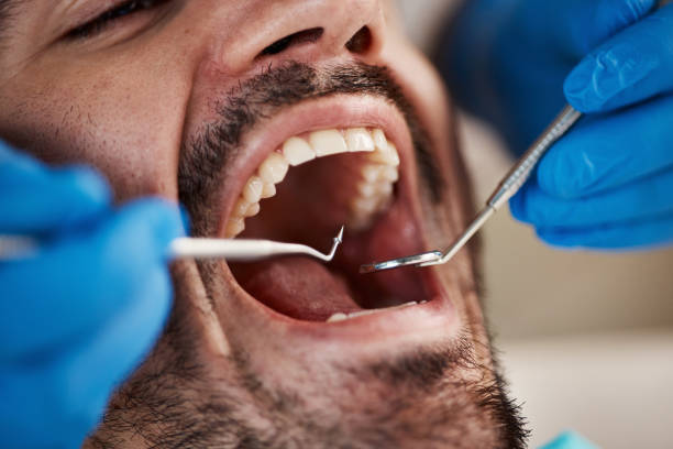 Best After-Hours Emergency Dentist in Aurora, MN